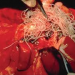 white heartworm show during surgery